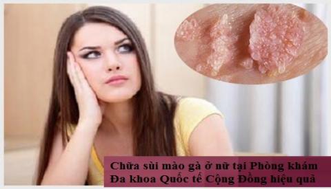 Tìm hiểu bệnh sùi mào gà ở nữ giới – Những biến chứng nguy hiểm