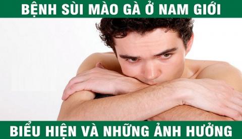 C&aacute;ch chữa bệnh s&ugrave;i m&agrave;o g&agrave; ở nam giới hiệu quả 
