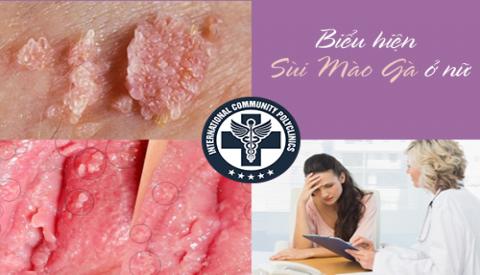 Biểu hiện nhận biết bệnh s&ugrave;i m&agrave;o g&agrave; ở nữ