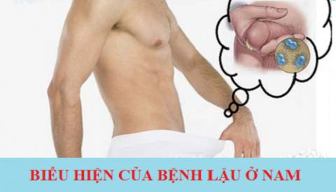 Những biểu hiện bệnh lậu ở nam giới cần lưu &yacute;