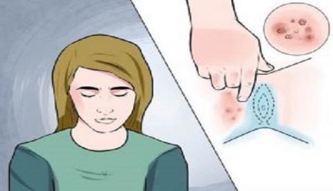 S&ugrave;i m&agrave;o g&agrave; ở &acirc;m đạo &ndash; nỗi &aacute;m ảnh nặng nề đối với phụ nữ