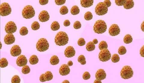 Triệu chứng của bệnh sùi mào gà