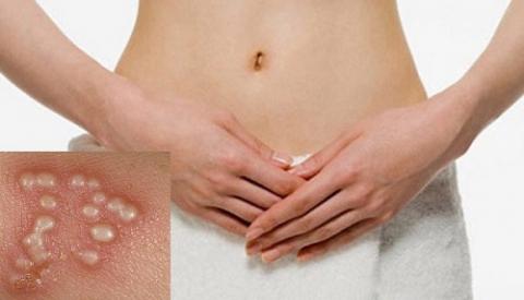 Nữ giới bị mọc nốt ở v&ugrave;ng k&iacute;n rất đ&aacute;ng lo nếu do c&aacute;c nguy&ecirc;n nh&acirc;n n&agrave;y