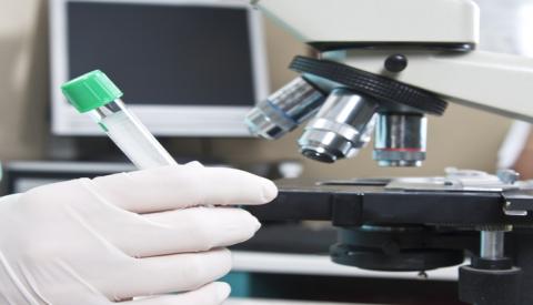 Làm những xét nghiệm gì để biết mắc mụn rộp sinh dục