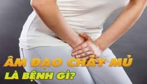 &Acirc;m đạo chảy mủ l&agrave; dấu hiệu của bệnh g&igrave;?
