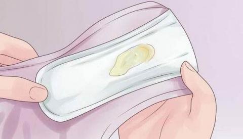 &Acirc;m đạo chảy mủ l&agrave; dấu hiệu của bệnh l&yacute; g&igrave;?