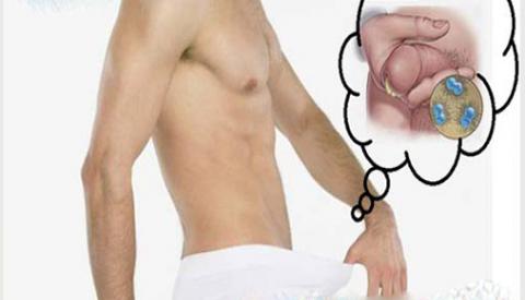 Bệnh lậu là gì? Nguyên nhân, triệu chứng và cách chữa bệnh
