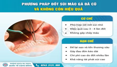 Đốt s&ugrave;i m&agrave;o g&agrave; c&oacute; c&ograve;n l&agrave; phương ph&aacute;p chữa bệnh hiệu quả?